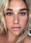 Kesha shows off freckles in new selfie, inspires others